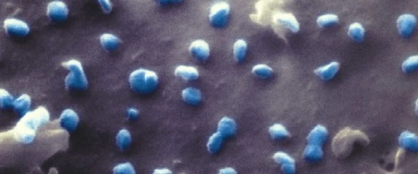 coronavirus-attacca-cellule-renali-1280x720