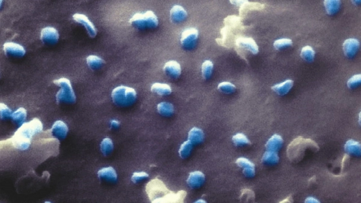 Immagini spettacolari: Gli scienziati, coordinati dalla dottoressa Natalie Frese, ricercatrice...