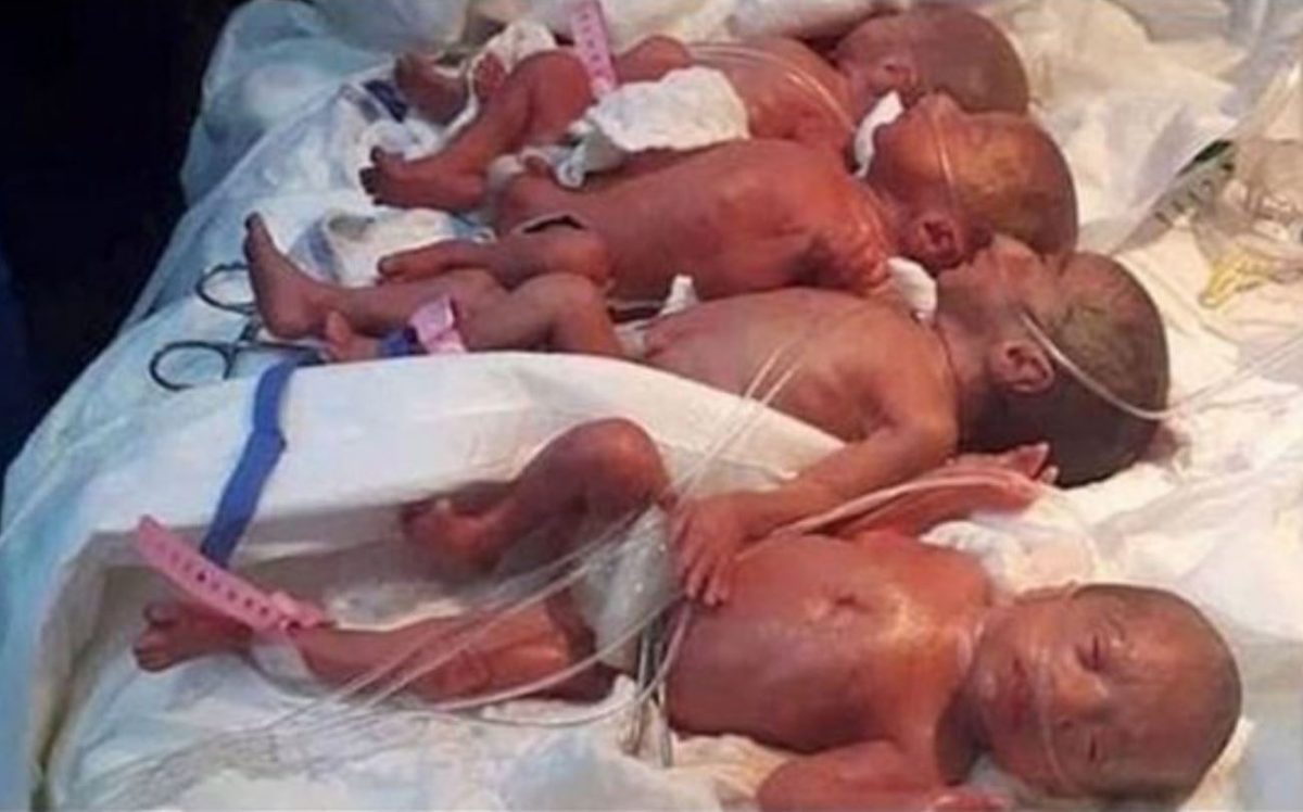 Parto da guinness in Marocco per una neomamma di nove gemelli. La donna ha dato alla luce ben nove...