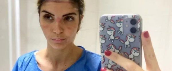 ricci-martina-infermiera-cardarelli-1603627440288-638x425