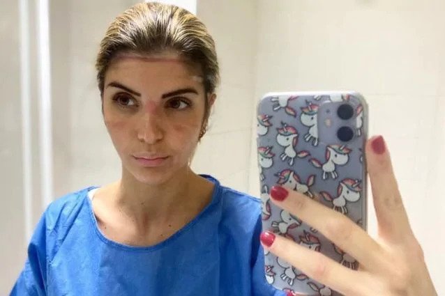 ricci-martina-infermiera-cardarelli-1603627440288-638x425